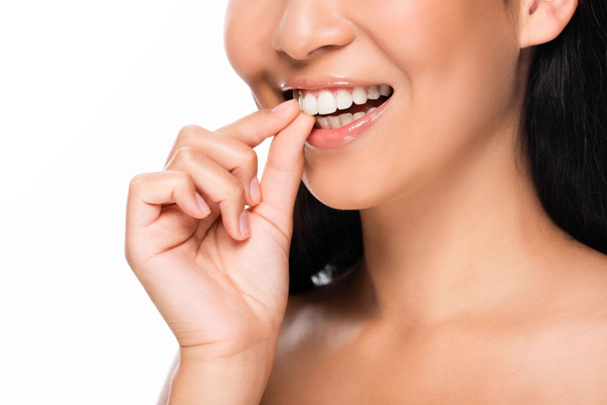 Veneers vs Crowns: Which Is Best for Your Teeth?