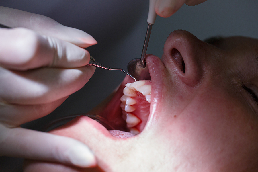 Understanding Gum Disease: Causes, Symptoms, and Treatment Options